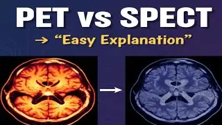 Nuclear Medicine Explained | PET vs SPECT in Simple Words