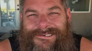 Syko Stu Shocking Recovery Update After Assault!
