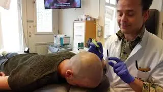 Micro haar pigmentatie / mhp  met Blond of grijs haar ?