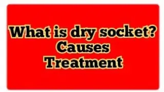 Dry socket and its causes| Dry socket| dry socket causes and treatment