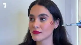 How To Get Natural Looking Cheek Filler