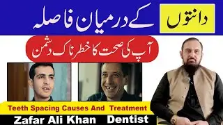 Gaps Between Teeth Explained: Causes, Symptoms, Risks & Treatments