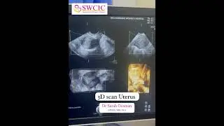 3D Uterus Scan | Dr. Sarah Oosman at SWCIC