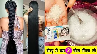 शैंपू में यह मिलाकर लगाया | बाल हो गए घुटने तक लंबे 😱 | Hair Growth Remedy