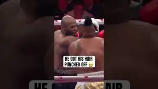 Jarrell Miller lost his toupee mid fight 😭 🥊 Live on @DAZNBoxing #Ring6