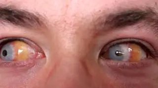 custom sclera zombie lenses by 9mm sfx