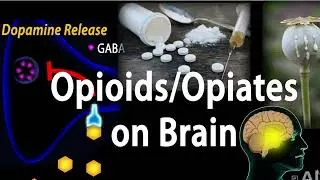 IBININI BIRIMUBWOKO BW'AMA OPIOID BYAMUGIZE IMBATA