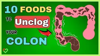 From Clogged To Clean | Top 10 Foods To Unclog Your Colon Fast