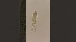 Death of a Ciliate 😞