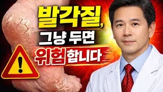 발각질, 그냥 두면 병 됩니다 (의사가 말하는 이유)