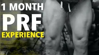 Meniscus Tear - 1 Month After PRF Therapy- Doing Goblet Squats I Miracle!