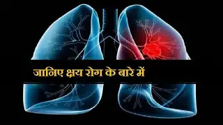 क्षय रोग ll Icnirp Tarmas