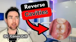 The Simple Science Behind Reversing Tooth Decay NATURALLY!