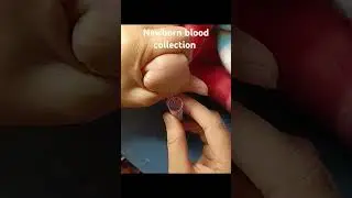 how to collect newborn baby blood sample । Newborn blood collection 🩺👩&zwj;⚕️#shortsvideo #shortsfeed