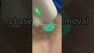 Is Laser Hair Removal Painful? #laserhairremoval