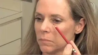 Where do you use soft tissue fillers like Restylane? By- Dr. Kridel
