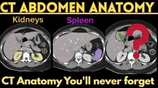 CT Abdomen and Pelvis Anatomy | 3 Min Labeled Radiology Slides