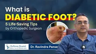 What is Diabetic Foot? 5 Life-Saving Tips by Dr. Orthopedic Surgeon | Chellaram Hospital