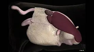 Abomasal displacement