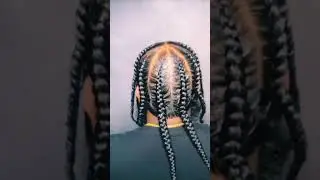 Flawless Braids on Balding Hair. #Black #Men #Natural Long #Hair #2023