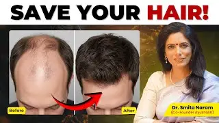 Stop Guessing Hair Fall Causes | Ayurveda Explains the Root Problem