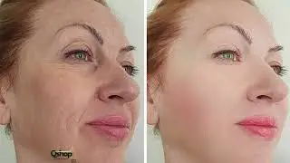 Anti Wrinkle Essence Restore Skin