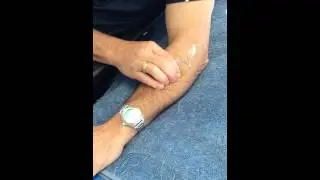 Tennis elbow treatment-self massage