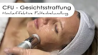 CFU - Gesichtsstraffung bei Beauty Mosaic