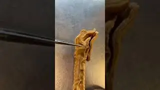 This Is a Real Human Vocal Cord