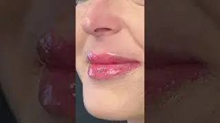 Valorizza le tue labbra con il trattamento Hydralips💋✨