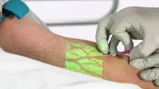 AccuVein AV500 Venipuncture Tip