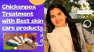My Chickenpox treatment | Best skincare products | Forever living