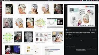 MNE-Python Tutorial for EEG and MEG data analysis and visualization.