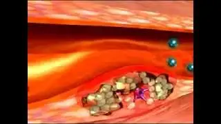 4life TF Cardio   Medical Authority Review   Transfer Factor