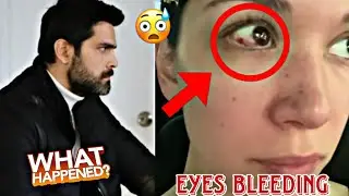 Hazal Subaşi Eyes bleeding and Erkan Meri&ccedil; what happened.by Usman Creation