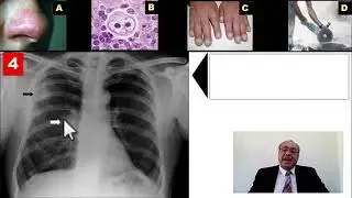 Medlearn (X-Ray Chest) [Quiz]- Answer