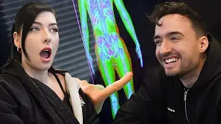 Her Reaction to My DEXA Scan&hellip; 😳