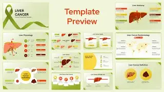 Liver Cancer PowerPoint Presentation Template Preview