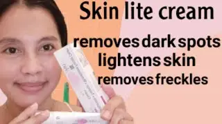 Skinlite cream Review naging effective ba sa pagwala ng pekas ko?