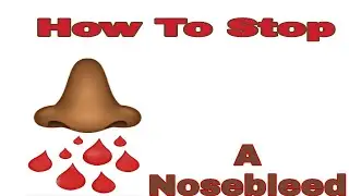 Quick Hack To Stop A Nosebleed