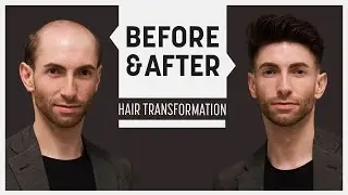Summer wave with a hybrid hair system
