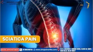 🔥 Sciatica Pain: Don&rsquo;t Let Back Pain Control Your Life