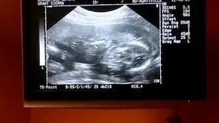 Finding out the WRONG gender of my baby