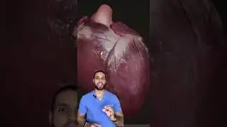 Coraz&oacute;n FANTASMA 👻