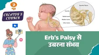 Creators Corner | Home Exercises for Erb&rsquo;s Palsy | Health Awareness