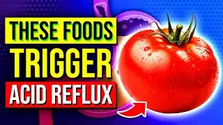 8 WORST Foods & Drinks To AVOID For Acid Reflux Relief 🚫🍽️
