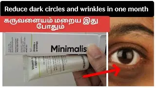 minimalist under eye cream review in tamil #vitamink #undereyedarkcircle