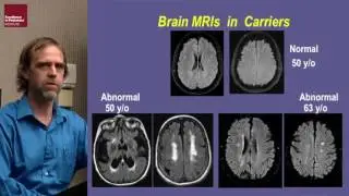 Robert Hopkin - Fabry Disease