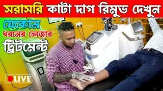 তিল, আঁচিল,মেসতা ট্যাটু দূর করার উপায় | Mole Removal cost |  How to mole remove BD