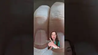 Dermatologist Reveals Dark Vertical Line On Your Nails Could Be Cancer (via Dr Lindsey Zubritsky)
